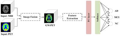 An Effective Multimodal Image Fusion Method Using MRI and PET for Alzheimer's Disease Diagnosis